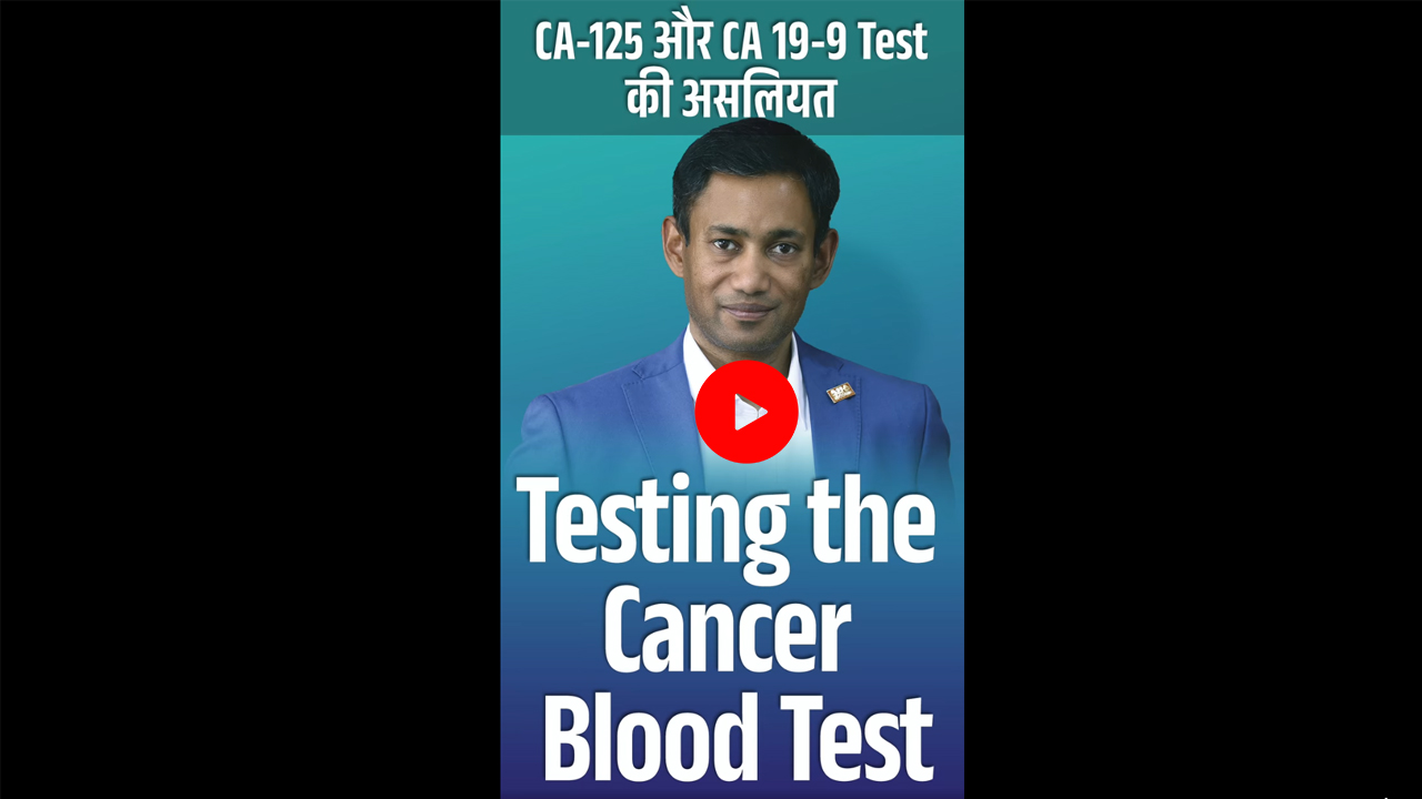 Testing Cancer Blood Test